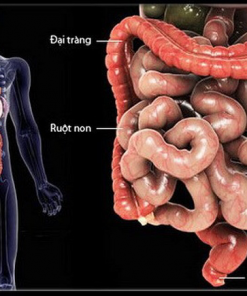 Công dụng nước ion kiềm đối với bệnh viêm đại tràng?